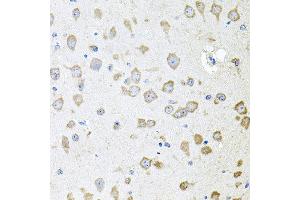 Immunohistochemistry of paraffin-embedded mouse brain using AKAP5 antibody at dilution of 1:100 (x40 lens).