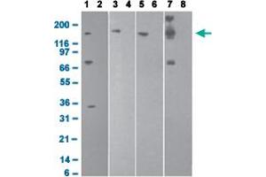Western blot analysis with DNMT1 monoclonal antibody, clone 60B1220. (DNMT1 抗体  (AA 637-650))