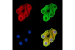ABIN7095853 and ABIN7099915 staining Hela cells by IF/ICC.