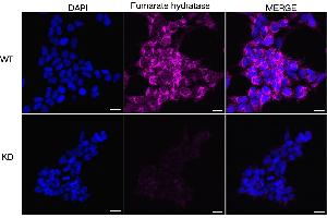 Immunocytochemical staining of HeLa cells using Fumarate hydratase antibody (ABIN7798665), 1:1,000), Top panel: wild-type (WT), Bottom panal: Fumarate hydratase shRNA knockdown (KD). (FH 抗体)
