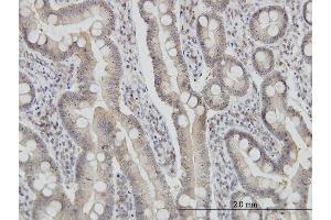 Immunoperoxidase of monoclonal antibody to FIS1 on formalin-fixed paraffin-embedded human small Intestine. (Fission 1 抗体  (AA 1-152))