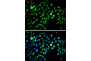 Immunofluorescence analysis of A549 cell using MTF2 antibody. (MTF2 抗体)