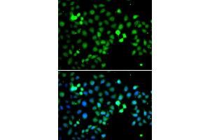 Immunofluorescence analysis of A549 cell using MTF2 antibody. (MTF2 抗体)