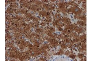 Image no. 2 for anti-Spermidine/Spermine N1-Acetyltransferase 2 (SAT2) antibody (ABIN1500807) (SAT2 抗体)