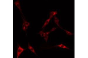 ABIN6269372 staining HeLa by IF/ICC. (LKB1 抗体  (Internal Region))