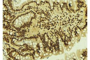 ABIN6273604 at 1/100 staining Mouse colon tissue by IHC-P. (ZNF71 抗体)