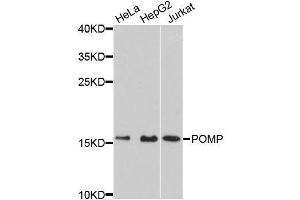 Western blot analysis of extracts of various cell lines, using POMP antibody (ABIN5996666) at 1:3000 dilution. (POMP 抗体)