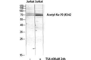 Western Blot (WB) analysis of JK lysis using Acetyl-Ku-70 (K542) antibody. (XRCC6 抗体  (acLys542))