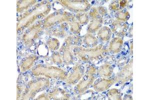 Immunohistochemistry of paraffin-embedded Rat kidney using PDCD6 Polyclonal Antibody at dilution of 1:200 (40x lens). (PDCD6 抗体)
