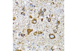 Immunohistochemistry of paraffin-embedded mouse spinal cord using MLC3A antibody (ABIN6134219, ABIN6143466, ABIN6143468 and ABIN6215215) at dilution of 1:100 (40x lens). (MAP1LC3A 抗体  (AA 1-100))
