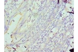 Immunohistochemistry of paraffin-embedded human colon using ABIN7160089 at dilution of 1:100 (MAD2L1 抗体  (AA 1-205))