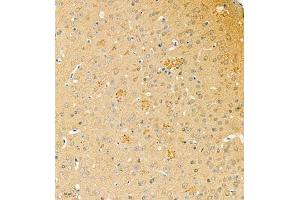 Immunohistochemistry of paraffin embedded mouse brain using phospho-TAU (S202/T205) (ABIN7075838) at dilution of 1: 1200 (tau 抗体  (pSer202, pThr205))