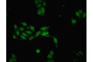 Immunofluorescent analysis of HepG2 cells using ABIN7149476 at dilution of 1:100 and Alexa Fluor 488-congugated AffiniPure Goat Anti-Rabbit IgG(H+L) (DACH1 抗体  (AA 166-369))