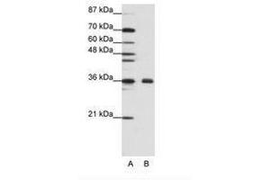 Image no. 2 for anti-Fibrillarin (FBL) (AA 61-110) antibody (ABIN307418)