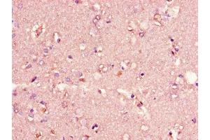 Immunohistochemistry of paraffin-embedded human brain tissue using ABIN7147273 at dilution of 1:100 (CIDEA 抗体  (AA 1-51))