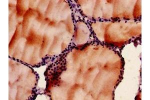 Immunohistochemistry of paraffin-embedded human thyroid tissue using ABIN7142951 at dilution of 1:100 (SLC33A1 抗体  (AA 1-74))