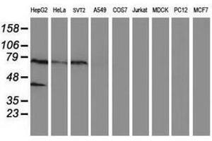 Image no. 1 for anti-Ankyrin Repeat Domain 53 (ANKRD53) (AA 1-300) antibody (ABIN1490720) (ANKRD53 抗体  (AA 1-300))