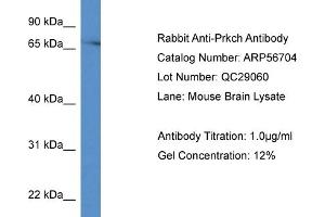Western Blotting (WB) image for anti-Protein Kinase C, eta (PRKCH) (C-Term) antibody (ABIN785834) (PKC eta 抗体  (C-Term))