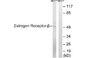 Western blot analysis of extracts from MCF-7 cells, using Estrogen Receptor-β (Ab-87) antibody. (ESR2 抗体  (Ser87))