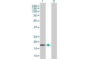 Western Blot analysis of GKN1 expression in transfected 293T cell line by GKN1 MaxPab polyclonal antibody. (Gastrokine 1 抗体  (AA 1-185))