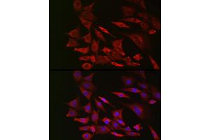 anti-Phosphatase and Tensin Homolog (PTEN) antibody