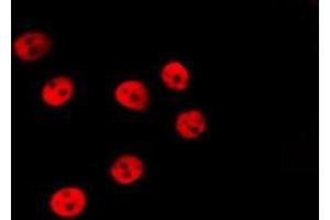 ABIN6277204 staining HepG2 by IF/ICC. (Histone 3 抗体  (H3K79me))