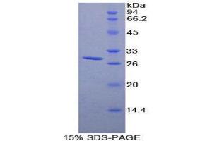 SDS-PAGE (SDS) image for DEAD (Asp-Glu-Ala-Asp) Box Polypeptide 58 (DDX58) (AA 1-211) protein (His tag) (ABIN2126666) (DDX58 Protein (AA 1-211) (His tag))
