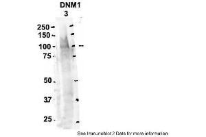 Sample Type: 3. (Dynamin 1 抗体  (Middle Region))