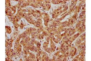 Immunohistochemistry (IHC) image for anti-Catenin (Cadherin-Associated Protein), beta 1, 88kDa (CTNNB1) (AA 2-781) antibody (ABIN7146984)