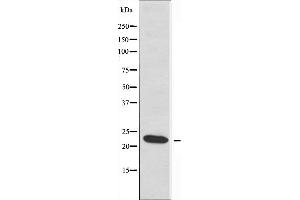 Western blot analysis of extracts from HeLa cells, using RPL17 antibody. (RPL17 抗体  (C-Term))