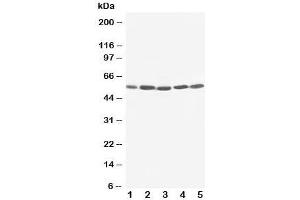 Western blot testing of KIM-1 antibody and Lane 1:  SMMC-7721;  2: HeLa;  3: PANC;  4: M231;  5: M453 cell lysate. (HAVCR1 抗体  (C-Term))