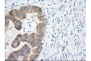 Immunohistochemical staining of paraffin-embedded Human Kidney tissue using anti-EIF2S1 mouse monoclonal antibody. (EIF2S1 抗体)