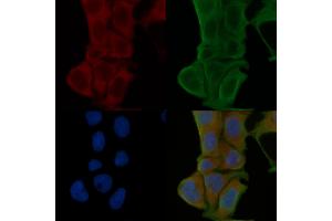 ABIN6264741 and ABIN6274043 staining Hela cells(24h of starvation treatment) by IF/ICC. (RhoA,B,C 抗体)