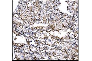 IHC analysis of DLGAP1 using anti-DLGAP1 antibody (ABIN7600257). (DLGAP1 抗体  (AA 17-319))