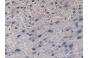 Detection of GR in Human Liver Tissue using Polyclonal Antibody to Glutathione Reductase (GR) (Glutathione Reductase 抗体  (AA 44-522))