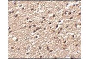 Immunohistochemistry of Stk39 in human brain tissue with this product at 2. (STK39 抗体  (C-Term))