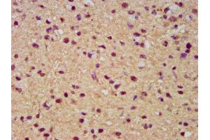 Immunohistochemistry (IHC) image for anti-Solute Carrier Family 19 (Thiamine Transporter), Member 2 (SLC19A2) (AA 209-285) antibody (ABIN7171980)