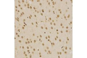 Immunohistochemistry of paraffin-embedded mouse brain using BMI1 antibody at dilution of 1:200 (x400 lens). (BMI1 抗体  (AA 120-326))