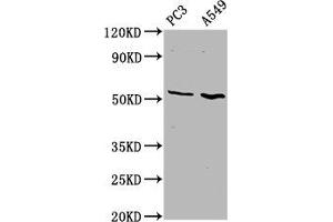 Western Blot Positive WB detected in: PC-3 whole cell lysate, A549 whole cell lysate All lanes: ETV5 antibody at 4. (ETV5 抗体  (AA 124-265))