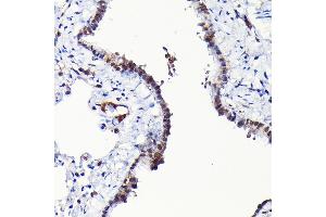 Immunohistochemistry of paraffin-embedded rat lung using RGS14 Rabbit pAb (ABIN6130669, ABIN6146917, ABIN6146918 and ABIN6225301) at dilution of 1:100 (40x lens).