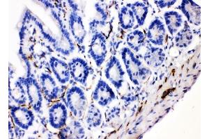 IHC analysis of VIP using anti-VIP antibody (ABIN4886760). (Vip 抗体  (Middle Region))