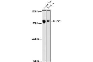 Western blot analysis of extracts of various cell lines, using NUP153 antibody (ABIN6133840, ABIN6144952 and ABIN7101835) at 1:1000 dilution. (NUP153 抗体)