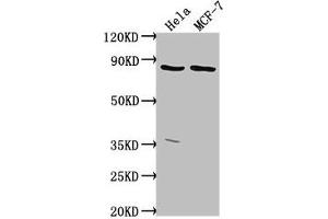 Western Blot Positive WB detected in: Hela whole cell lysate, MCF-7 whole cell lysate All lanes: TTC39B antibody at 1:2000 Secondary Goat polyclonal to rabbit IgG at 1/50000 dilution Predicted band size: 77, 67, 76, 60, 70, 23 kDa Observed band size: 77 kDa (TTC39B 抗体  (AA 10-122))