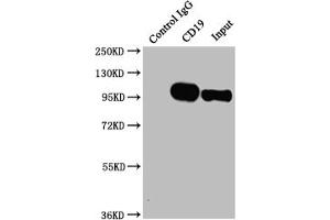 Western Blotting (WB) image for anti-CD19 Molecule (CD19) antibody (ABIN7127396)