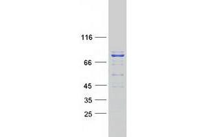 Western Blotting (WB) image for Diacylglycerol Kinase, alpha 80kDa (DGKA) (Transcript Variant 4) protein (Myc-DYKDDDDK Tag) (ABIN2712276)