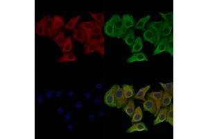 Phospho-p23 (Ser113) Antibody staining Hela cells(heat shock treatment) by IF/ICC. (CDK5R1 抗体  (pSer113))