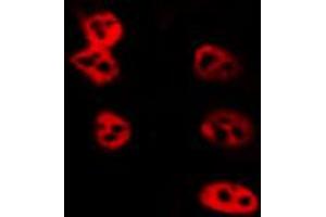 ABIN6274017 staining LOVO by IF/ICC. (H2AFZ 抗体)