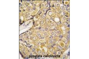 Immunohistochemistry (Paraffin-embedded Sections) (IHC (p)) image for anti-Transient Receptor Potential Cation Channel, Subfamily M, Member 8 (TRPM8) (AA 521-552) antibody (ABIN392820)