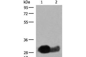 Western blot analysis of Raji cell Human spleen tissue lysates using HLA-DRB1 Polyclonal Antibody at dilution of 1:550 (HLA-DRB1 抗体)