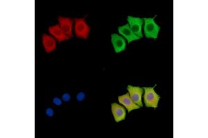 GK5 Antibody staining Hela cells by IF/ICC. (GK5 抗体)
